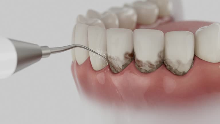 Trusted Emergency Dentist service in Johns Creek, GA - Dentist Open Now